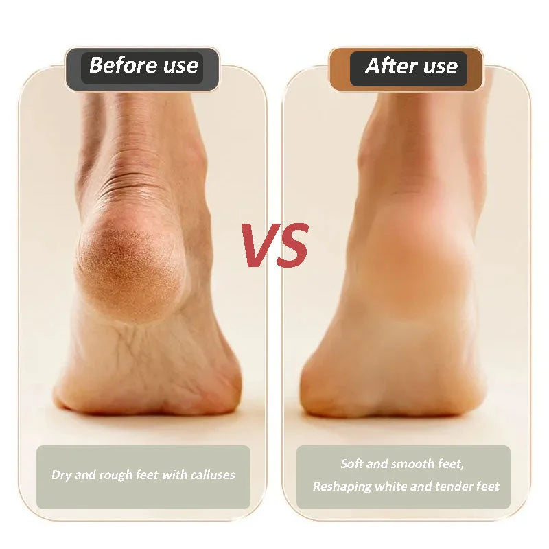 ⏰Big Sale 49% OFF⏰2024 NEW USB Rechargeable Foot Repair and Grinding Device-8