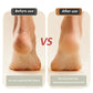【💥Final 3-hour Preferential Deal 💥】Buy 2 get 1 free🔥USB Rechargeable Foot Repair and Grinding Device