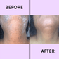 🔥Last Day 49% OFF🔥-Special Offer Now✨Facial Hair Removal Cream Kit