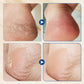 BUY 1 GET 1 FREE🔥Hydrating and Anti-Cracking Foot Cream