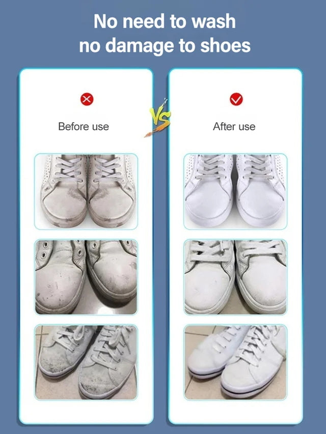 Stain Removal & Whitening Shoe Shine-2